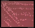Yersinia enterocolitica on agar